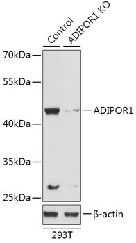 ADIPOR1 Rabbit Polyclonal Antibody [KO Validated]