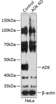 ADK Rabbit Polyclonal Antibody [KO Validated]