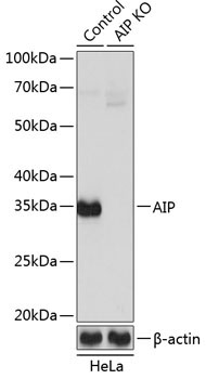 AIP Rabbit Polyclonal Antibody [KO Validated]