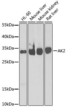 AK2 Rabbit Polyclonal Antibody [KO Validated]