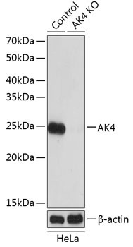 AK4 Rabbit Polyclonal Antibody [KO Validated]