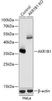 AKR1B1 Rabbit Polyclonal Antibody [KO Validated]