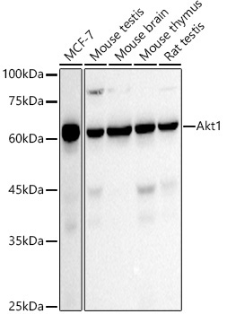 AKT1 Rabbit Monoclonal Antibody [KO Validated]