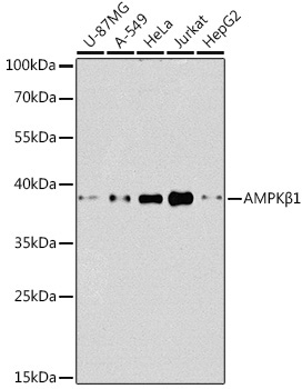 AMPKBeta1 Rabbit Polyclonal Antibody [KO Validated]