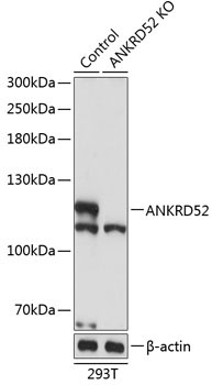 ANKRD52 Rabbit Polyclonal Antibody [KO Validated]