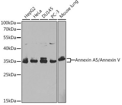 Annexin A5/Annexin V Rabbit Polyclonal Antibody [KO Validated]