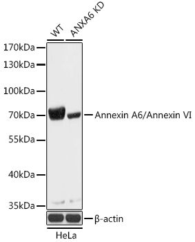 Annexin A6/Annexin VI Rabbit Polyclonal Antibody [KO Validated]