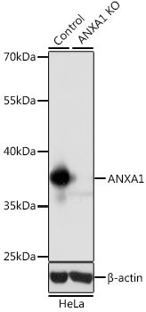 ANXA1 Rabbit Polyclonal Antibody [KO Validated]