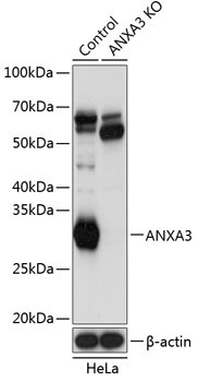 ANXA3 Rabbit Polyclonal Antibody [KO Validated]