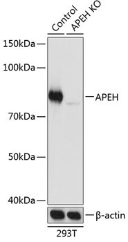 APEH Rabbit Polyclonal Antibody [KO Validated]