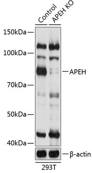 APEH Rabbit Polyclonal Antibody [KO Validated]