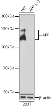 APP Rabbit Monoclonal Antibody [KO Validated]