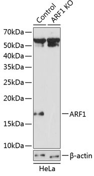 ARF1 Rabbit Polyclonal Antibody [KO Validated]