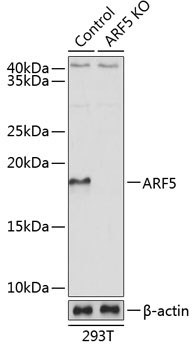 ARF5 Rabbit Polyclonal Antibody [KO Validated]