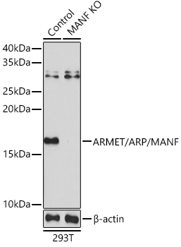 ARMET/ARP/MANF Rabbit Polyclonal Antibody [KO Validated]