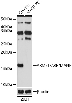 ARMET/ARP/MANF Rabbit Polyclonal Antibody [KO Validated]