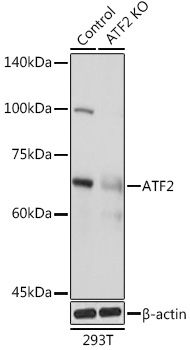 ATF2 Rabbit Polyclonal Antibody [KO Validated]