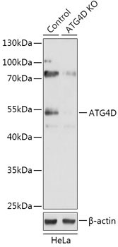 ATG4D Rabbit Polyclonal Antibody [KO Validated]