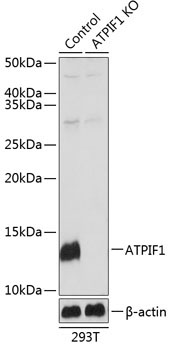 ATPIF1 Rabbit Polyclonal Antibody [KO Validated]