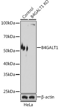 B4GALT1 Rabbit Polyclonal Antibody [KO Validated]