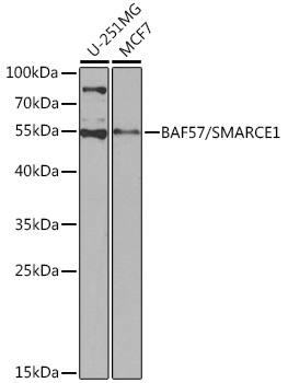 BAF57/SMARCE1 Rabbit Polyclonal Antibody [KO Validated]
