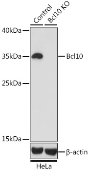 Bcl10 Rabbit Polyclonal Antibody [KO Validated]