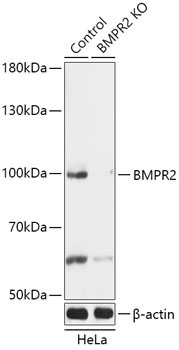 BMPR2 Rabbit Polyclonal Antibody [KO Validated]