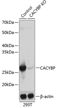 CACYBP Rabbit Polyclonal Antibody [KO Validated]