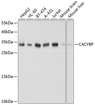 CACYBP Rabbit Polyclonal Antibody [KO Validated]