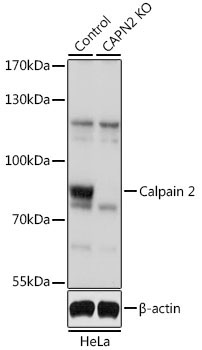Calpain 2 Rabbit Polyclonal Antibody [KO Validated]