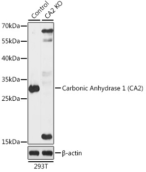 Carbonic Anhydrase 2 (CA2) Rabbit Polyclonal Antibody [KO Validated]