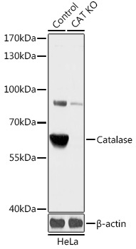 Catalase Rabbit Polyclonal Antibody [KO Validated]