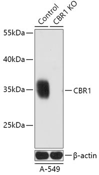 CBR1 Rabbit Polyclonal Antibody [KO Validated]
