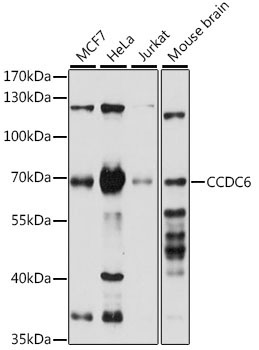 CCDC6 Rabbit Polyclonal Antibody [KO Validated]