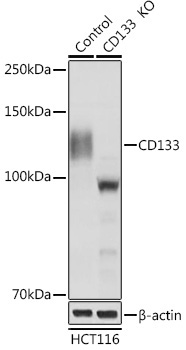 CD133 Rabbit Polyclonal Antibody [KO Validated]