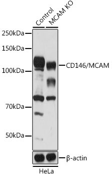 CD146/MCAM Rabbit Polyclonal Antibody [KO Validated]