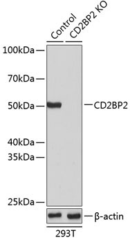 CD2BP2 Rabbit Polyclonal Antibody [KO Validated]