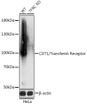 CD71/Transferrin Receptor Rabbit Polyclonal Antibody [KO Validated]