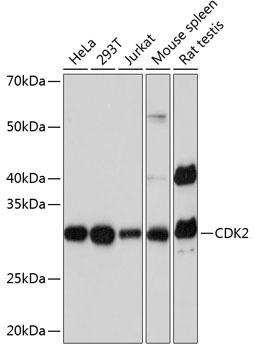 CDK2 Rabbit Monoclonal Antibody [KO Validated]