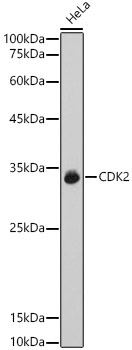 CDK2 Rabbit Polyclonal Antibody [KO Validated]