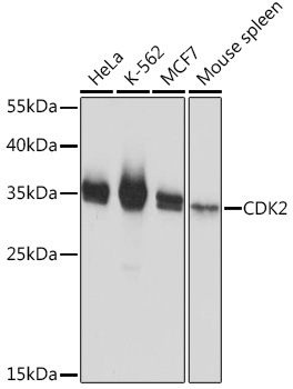 CDK2 Rabbit Polyclonal Antibody [KO Validated]