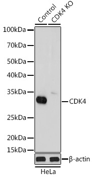 CDK4 Rabbit Polyclonal Antibody [KO Validated]