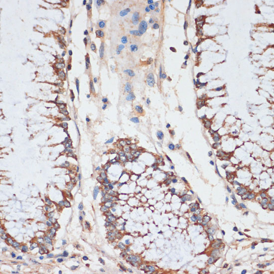 CDK4 Rabbit Polyclonal Antibody [KO Validated]