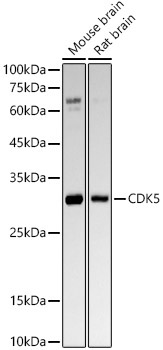 CDK5 Rabbit Monoclonal Antibody [KO Validated]