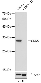 CDK5 Rabbit Polyclonal Antibody [KO Validated]