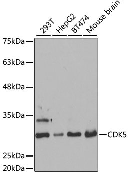 CDK5 Rabbit Polyclonal Antibody [KO Validated]