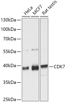 CDK7 Rabbit Polyclonal Antibody [KO Validated]