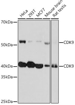 CDK9 Rabbit Monoclonal Antibody [KO Validated]