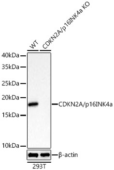 CDKN2A/p16INK4a Rabbit Monoclonal Antibody [KO Validated]