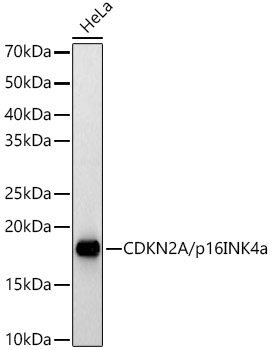 CDKN2A/p16INK4a Rabbit Polyclonal Antibody [KO Validated]